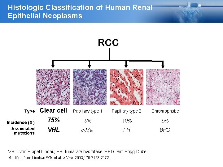 Histologic Classification of Human Renal Epithelial Neoplasms RCC Type Incidence (%) Associated mutations Clear