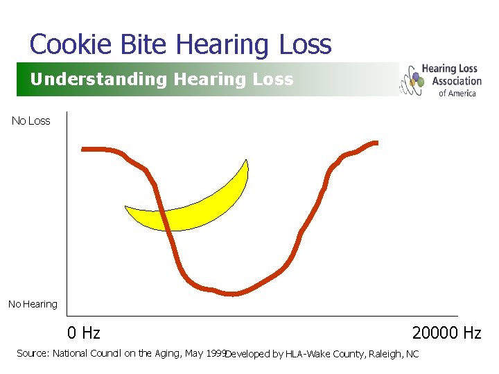 Cookie Bite Hearing Loss Understanding Hearing Loss No Hearing 0 Hz 20000 Hz Source:
