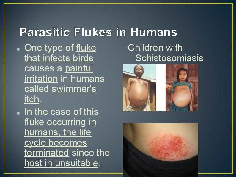 Parasitic Flukes in Humans One type of fluke that infects birds causes a painful