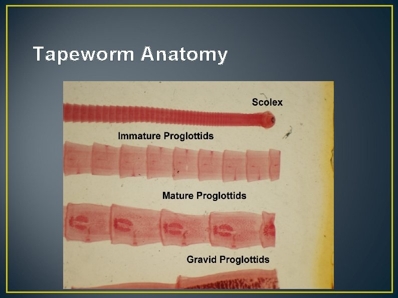 Tapeworm Anatomy 