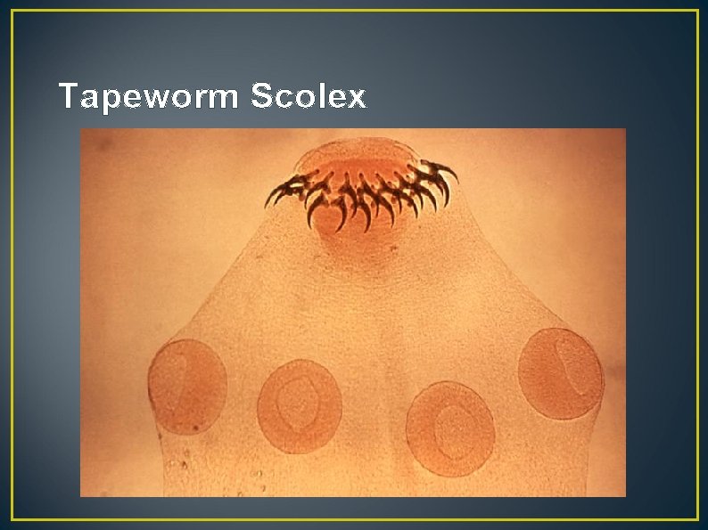 Tapeworm Scolex 