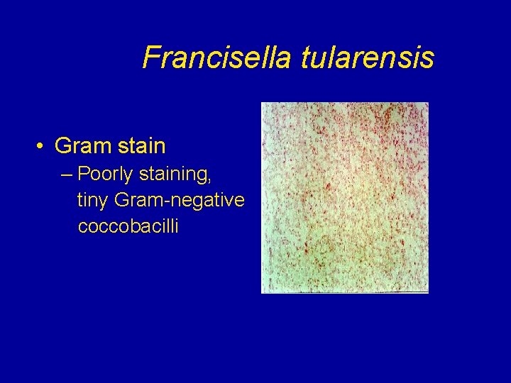 Francisella tularensis • Gram stain – Poorly staining, tiny Gram-negative coccobacilli Francisella tularensis • Gram stain – Poorly staining, tiny Gram-negative coccobacilli