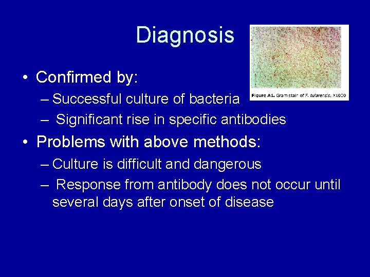Diagnosis • Confirmed by: – Successful culture of bacteria – Significant rise in specific Diagnosis • Confirmed by: – Successful culture of bacteria – Significant rise in specific