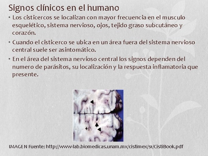 Signos clínicos en el humano • Los cisticercos se localizan con mayor frecuencia en