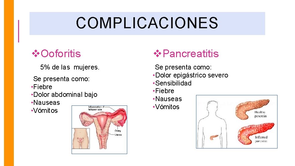 COMPLICACIONES v. Ooforitis v. Pancreatitis 5% de las mujeres. Se presenta como: • Dolor