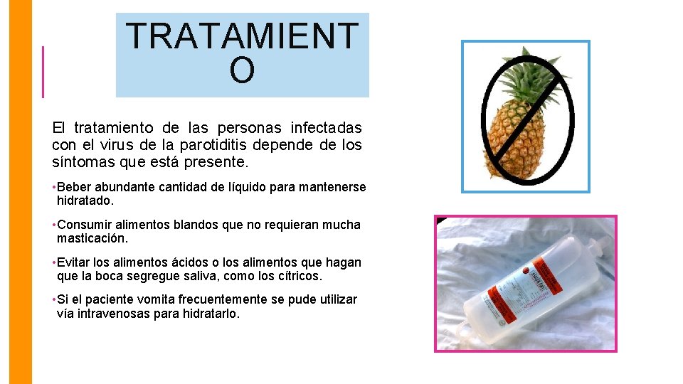 TRATAMIENT O El tratamiento de las personas infectadas con el virus de la parotiditis