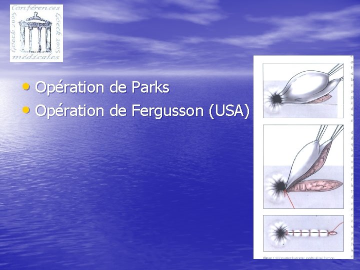  • Opération de Parks • Opération de Fergusson (USA) 