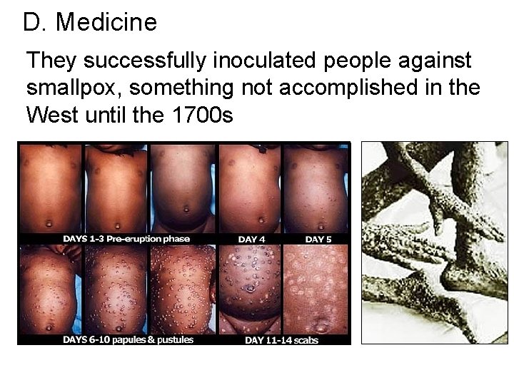 D. Medicine They successfully inoculated people against smallpox, something not accomplished in the West