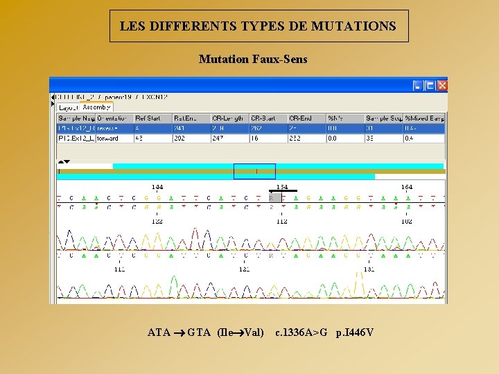LES DIFFERENTS TYPES DE MUTATIONS Mutation Faux-Sens ATA GTA (Ile Val) c. 1336 A>G