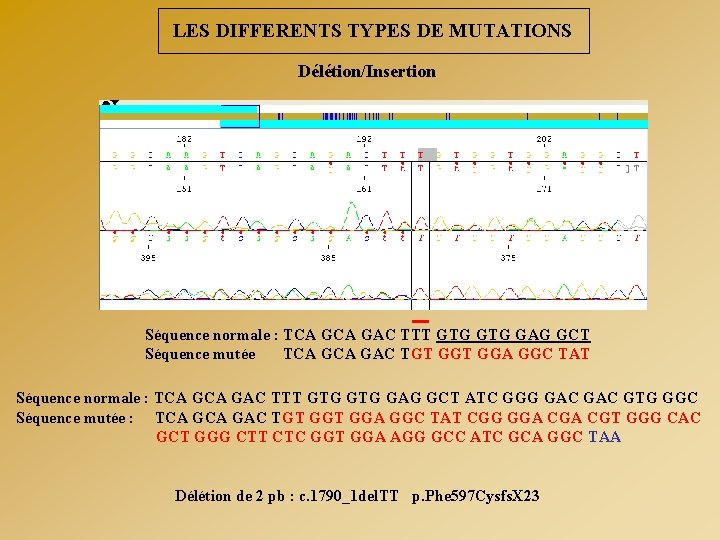 LES DIFFERENTS TYPES DE MUTATIONS Délétion/Insertion Séquence normale : TCA GAC TTT GTG GAG