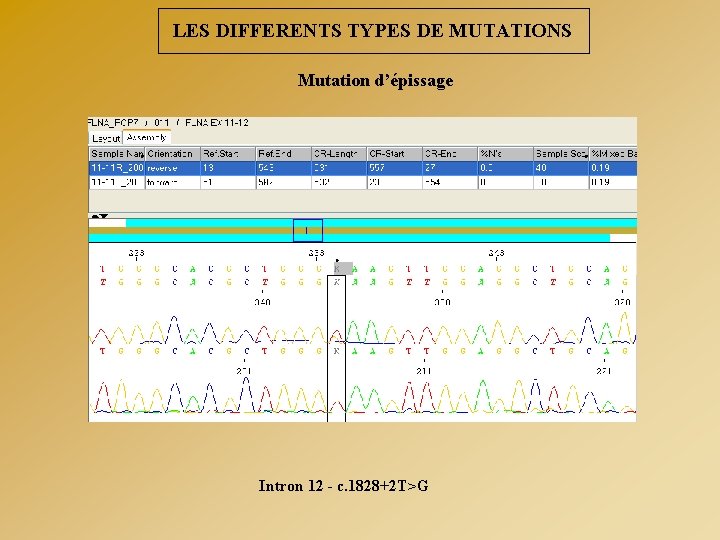 LES DIFFERENTS TYPES DE MUTATIONS Mutation d’épissage Intron 12 - c. 1828+2 T>G 