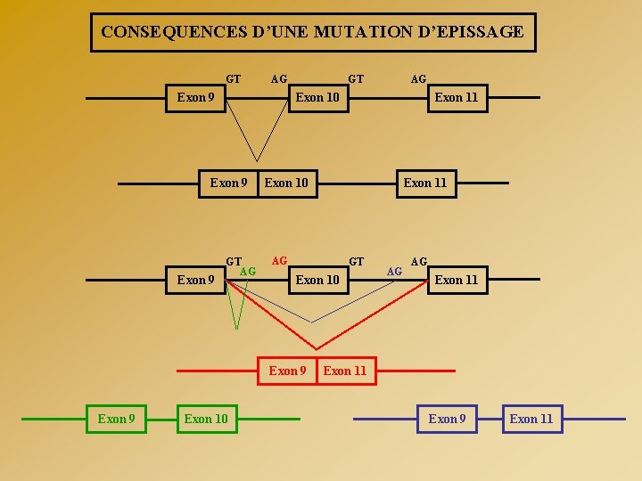 CONSEQUENCES D’UNE MUTATION D’EPISSAGE GT AG Exon 9 GT AG Exon 10 Exon 11