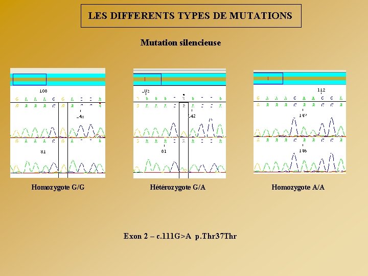 LES DIFFERENTS TYPES DE MUTATIONS Mutation silencieuse Homozygote G/G Hétérozygote G/A Exon 2 –