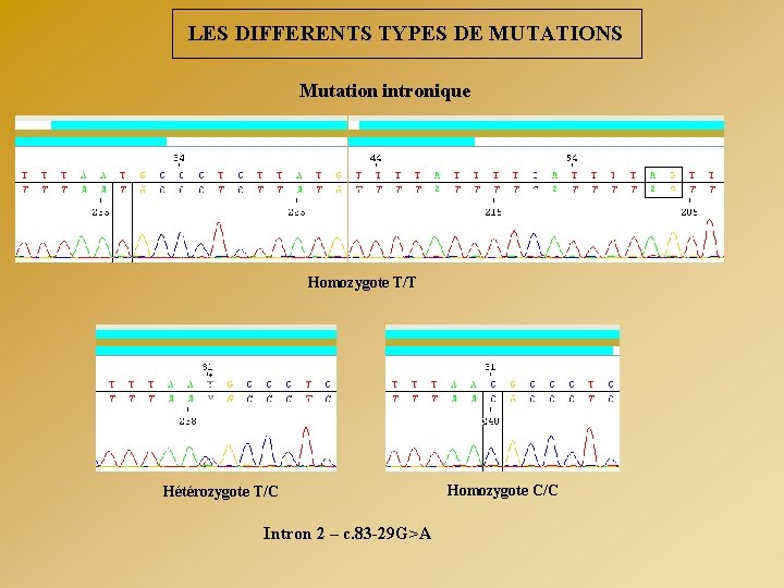 LES DIFFERENTS TYPES DE MUTATIONS Mutation intronique Homozygote T/T Hétérozygote T/C Intron 2 –