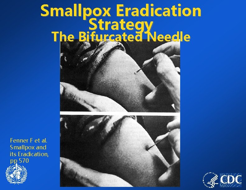 Smallpox Eradication Strategy The Bifurcated Needle Fenner F et al. Smallpox and its Eradication,