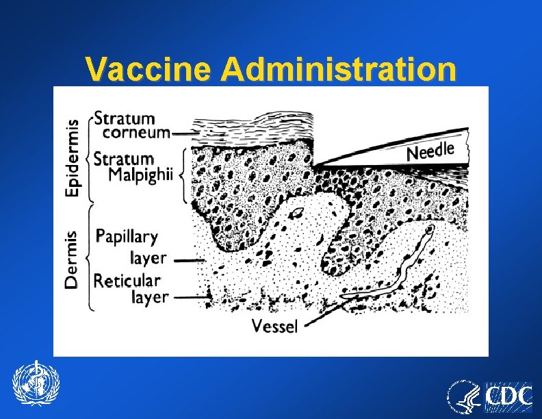 Vaccine Administration 