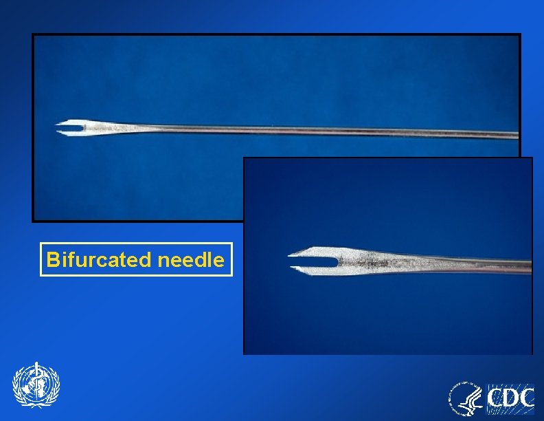 Bifurcated needle 