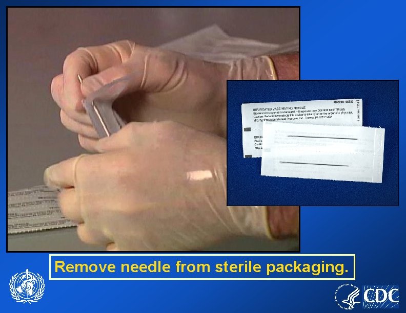 Remove needle from sterile packaging. 