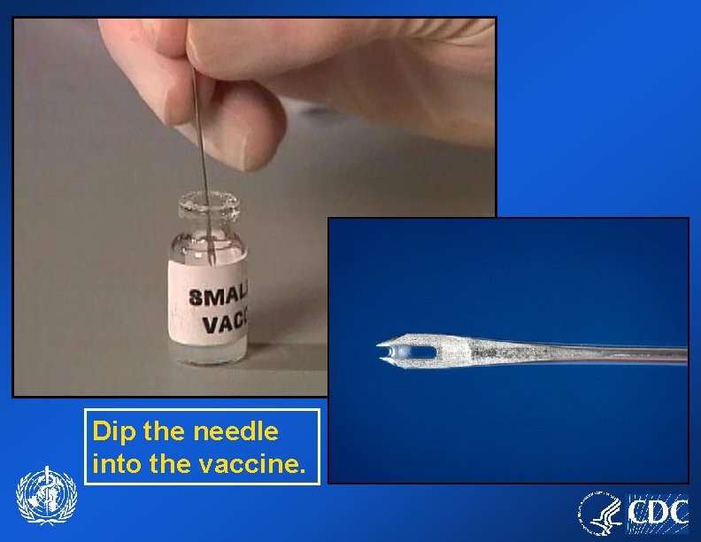 Dip the needle into the vaccine. 