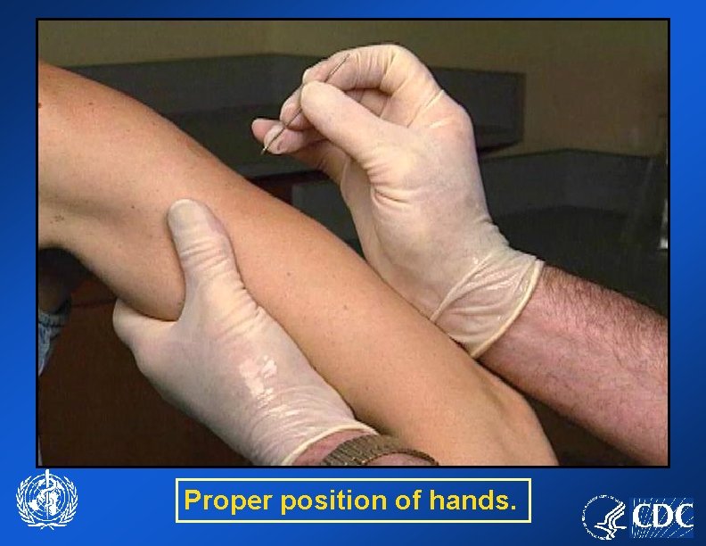 Proper position of hands. 