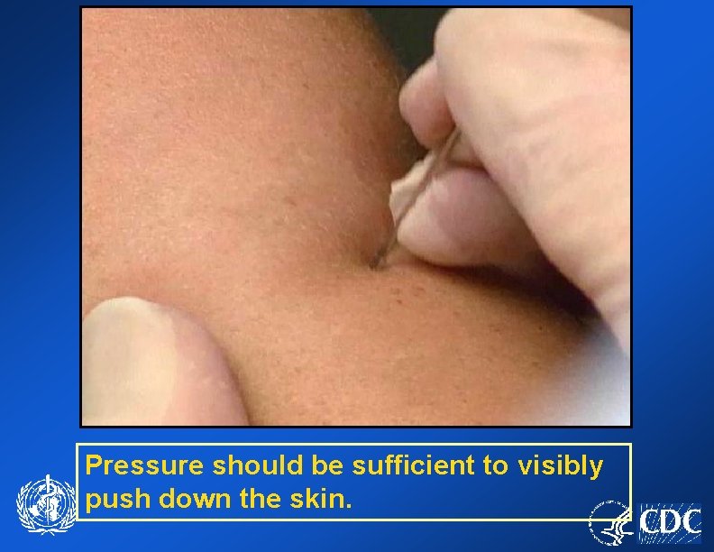 Pressure should be sufficient to visibly push down the skin. 