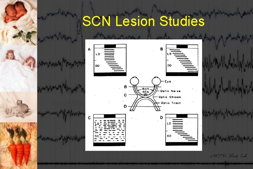 SCN Lesion Studies 