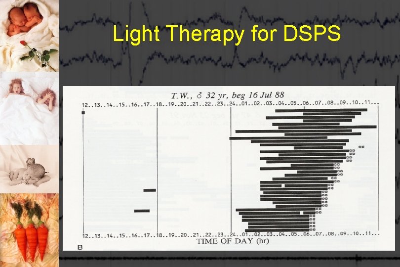 Light Therapy for DSPS 