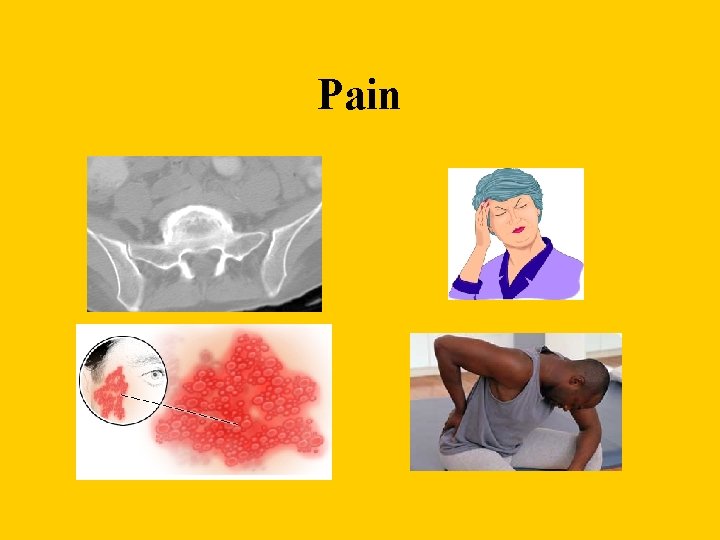 Pain 