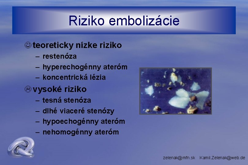 Riziko embolizácie J teoreticky nízke riziko – restenóza – hyperechogénny ateróm – koncentrická lézia