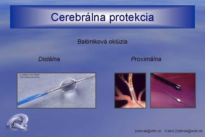 Cerebrálna protekcia Balóniková oklúzia Distálna Proximálna zelenak@mfn. sk Kamil. Zelenak@web. de 