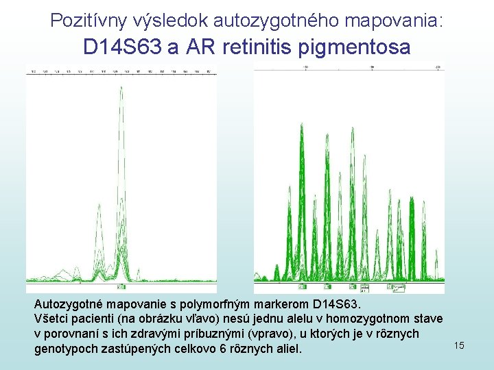 Pozitívny výsledok autozygotného mapovania: D 14 S 63 a AR retinitis pigmentosa Autozygotné mapovanie Pozitívny výsledok autozygotného mapovania: D 14 S 63 a AR retinitis pigmentosa Autozygotné mapovanie