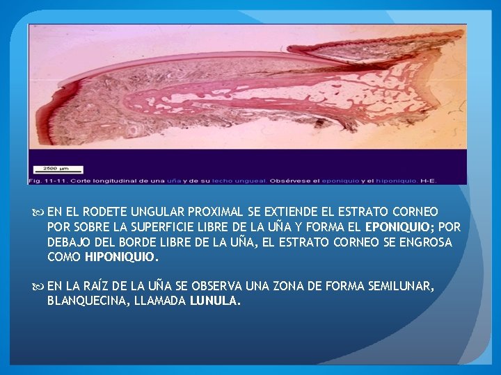  EN EL RODETE UNGULAR PROXIMAL SE EXTIENDE EL ESTRATO CORNEO POR SOBRE LA