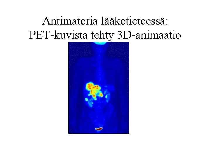 Antimateria lääketieteessä: PET-kuvista tehty 3 D-animaatio 