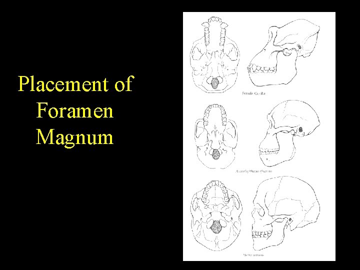 Placement of Foramen Magnum 