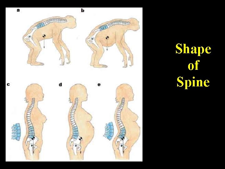 Shape of Spine 