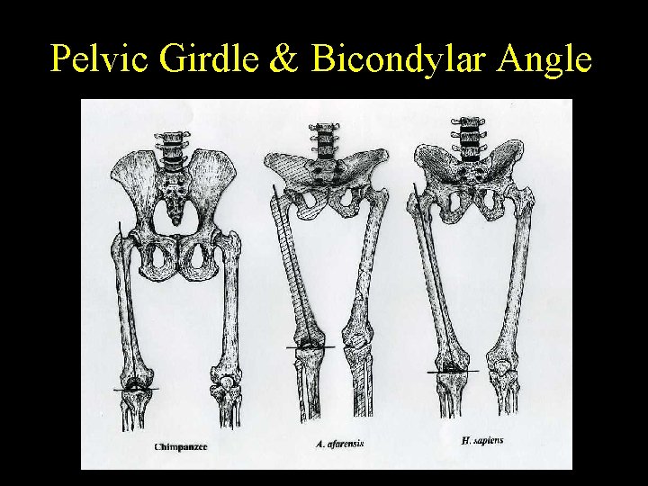 Pelvic Girdle & Bicondylar Angle 