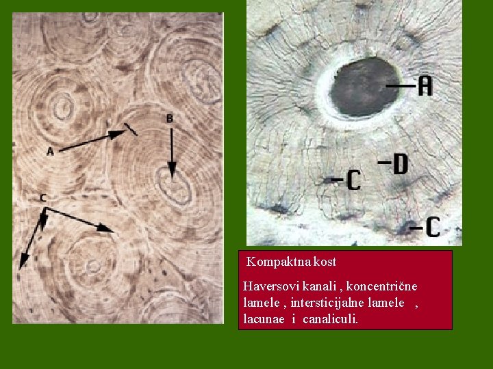Kompaktna kost Haversovi kanali , koncentrične lamele , intersticijalne lamele , lacunae i canaliculi.
