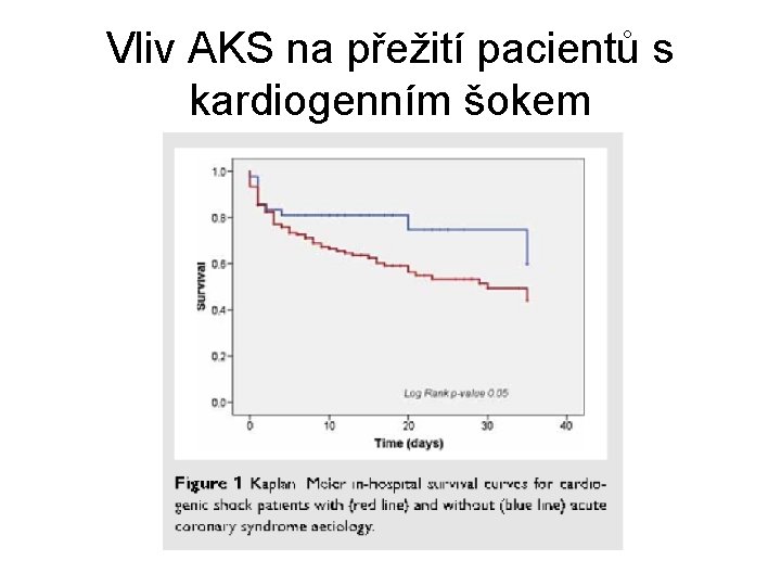 Vliv AKS na přežití pacientů s kardiogenním šokem 