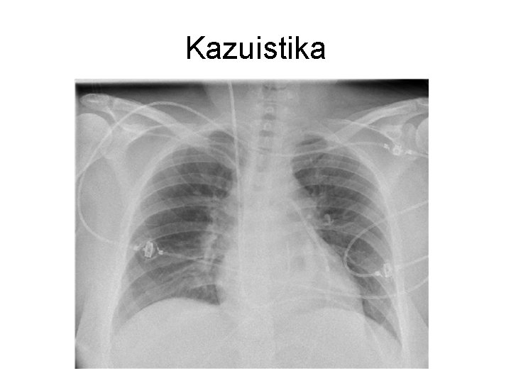 Kazuistika 