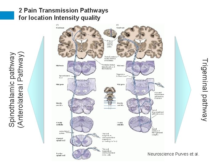 Trigeminal pathway Spinothalamic pathway (Anterolateral Pathway) 2 Pain Transmission Pathways for location Intensity quality