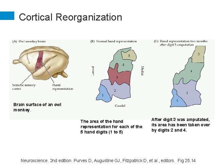 Cortical Reorganization Brain surface of an owl monkey. The area of the hand representation