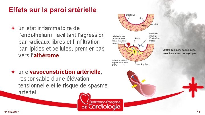 Effets sur la paroi artérielle un état inflammatoire de l’endothélium, facilitant l’agression par radicaux