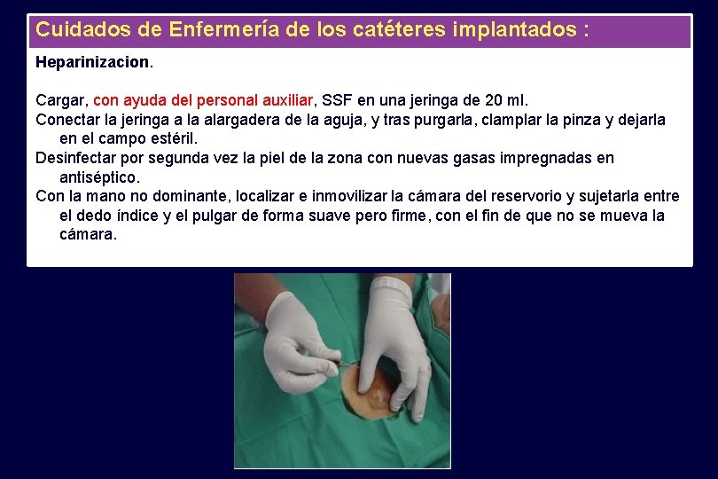 Cuidados de Enfermería de los catéteres implantados : Heparinizacion. Cargar, con ayuda del personal