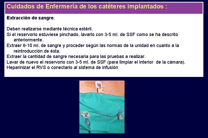 Cuidados de Enfermería de los catéteres implantados : Extracción de sangre. Deben realizarse mediante