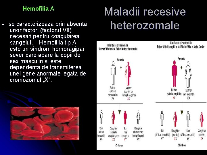  Hemofilia A - se caracterizeaza prin absenta unor factori (factorul VII) necesari pentru