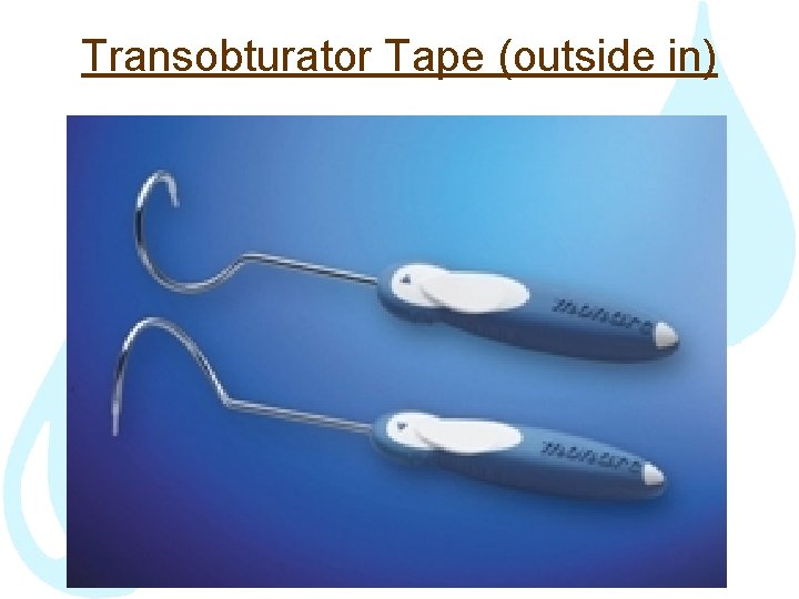 Transobturator Tape (outside in) 
