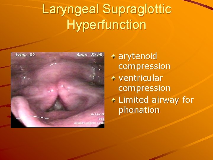 Laryngeal Supraglottic Hyperfunction arytenoid compression ventricular compression Limited airway for phonation 