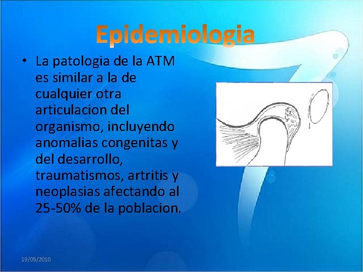  • La patologia de la ATM es similar a la de cualquier otra