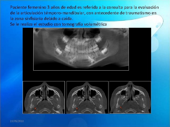 Paciente femenino 3 años de edad es referida a la consulta para la evaluación