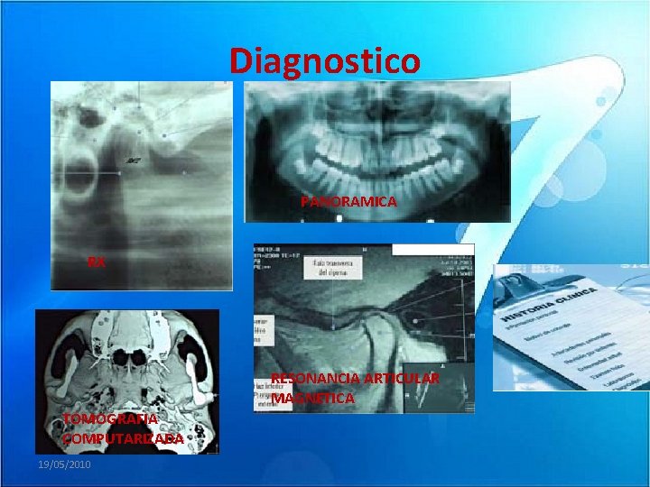 Diagnostico PANORAMICA RX RESONANCIA ARTICULAR MAGNETICA TOMOGRAFIA COMPUTARIZADA 19/05/2010 